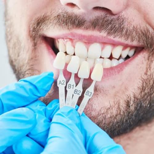 Pediatric Dentistry Treatment at Gupta Dental Dwarka