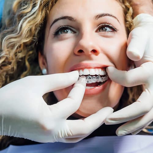 Veneer Specialist Treatment at Gupta Dental Dwarka