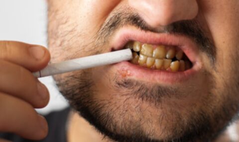 tobacco affect oral health